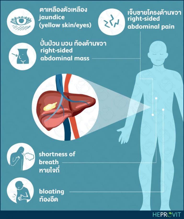 HEPROVIT เฮโปรวิท ฟื้นฟูตับไบำรุงตับ รักษาตับ ดีท็อกซ์ตับ ล้างสารพิษตับ ไขมันพอกตับ ตับอักเสบ ตับแข็ง ไวรัสตับอักเสบเอ ไวรัสตับอักเสบบี ไวรัสตับอักเสบซี มะเร็งตับ ตาเหลืองตัวเหลือง เจ็บชายโครงด้านขวา ง่วงกลางวัน ตื่นกลางคืน ดื่มแล้วเป็นผื่นแดง คันตามตัวไม่มีสาเหตุ มือเท้าบวม ท้องมาน ปวดตามข้อ ท้องอืด แน่น หายใจไม่สะดวก ดื่มเหล้า สุรา อ้วน ไขมัน