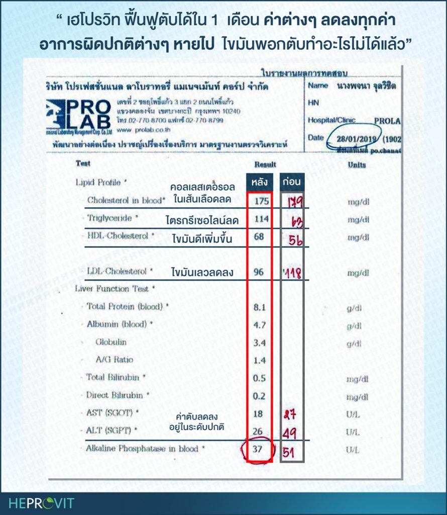 HEPROVIT เฮโปรวิท ฟื้นฟูตับไบำรุงตับ รักษาตับ ดีท็อกซ์ตับ ล้างสารพิษตับ ไขมันพอกตับ ตับอักเสบ ตับแข็ง ไวรัสตับอักเสบเอ ไวรัสตับอักเสบบี ไวรัสตับอักเสบซี มะเร็งตับ ตาเหลืองตัวเหลือง เจ็บชายโครงด้านขวา ง่วงกลางวัน ตื่นกลางคืน ดื่มแล้วเป็นผื่นแดง คันตามตัวไม่มีสาเหตุ มือเท้าบวม ท้องมาน ปวดตามข้อ ท้องอืด แน่น หายใจไม่สะดวก ดื่มเหล้า สุรา อ้วน ไขมัน