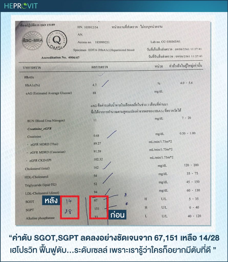 HEPROVIT เฮโปรวิท ฟื้นฟูตับไบำรุงตับ รักษาตับ ดีท็อกซ์ตับ ล้างสารพิษตับ ไขมันพอกตับ ตับอักเสบ ตับแข็ง ไวรัสตับอักเสบเอ ไวรัสตับอักเสบบี ไวรัสตับอักเสบซี มะเร็งตับ ตาเหลืองตัวเหลือง เจ็บชายโครงด้านขวา ง่วงกลางวัน ตื่นกลางคืน ดื่มแล้วเป็นผื่นแดง คันตามตัวไม่มีสาเหตุ มือเท้าบวม ท้องมาน ปวดตามข้อ ท้องอืด แน่น หายใจไม่สะดวก ดื่มเหล้า สุรา อ้วน ไขมัน