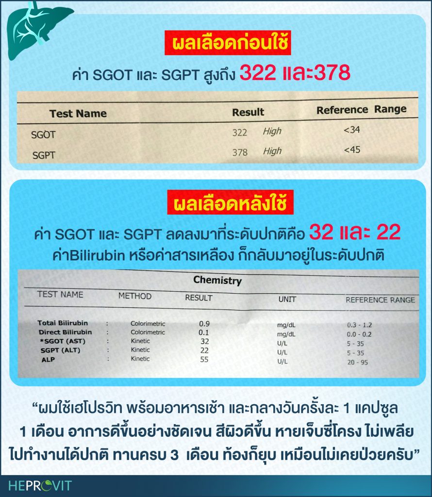 HEPROVIT เฮโปรวิท ฟื้นฟูตับไบำรุงตับ รักษาตับ ดีท็อกซ์ตับ ล้างสารพิษตับ ไขมันพอกตับ ตับอักเสบ ตับแข็ง ไวรัสตับอักเสบเอ ไวรัสตับอักเสบบี ไวรัสตับอักเสบซี มะเร็งตับ ตาเหลืองตัวเหลือง เจ็บชายโครงด้านขวา ง่วงกลางวัน ตื่นกลางคืน ดื่มแล้วเป็นผื่นแดง คันตามตัวไม่มีสาเหตุ มือเท้าบวม ท้องมาน ปวดตามข้อ ท้องอืด แน่น หายใจไม่สะดวก ดื่มเหล้า สุรา อ้วน ไขมัน