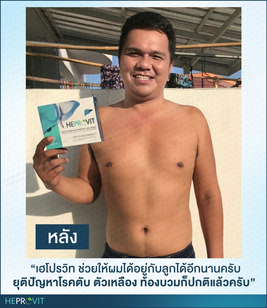 HEPROVIT เฮโปรวิท ฟื้นฟูตับไบำรุงตับ รักษาตับ ดีท็อกซ์ตับ ล้างสารพิษตับ ไขมันพอกตับ ตับอักเสบ ตับแข็ง ไวรัสตับอักเสบเอ ไวรัสตับอักเสบบี ไวรัสตับอักเสบซี มะเร็งตับ ตาเหลืองตัวเหลือง เจ็บชายโครงด้านขวา ง่วงกลางวัน ตื่นกลางคืน ดื่มแล้วเป็นผื่นแดง คันตามตัวไม่มีสาเหตุ มือเท้าบวม ท้องมาน ปวดตามข้อ ท้องอืด แน่น หายใจไม่สะดวก ดื่มเหล้า สุรา อ้วน ไขมัน