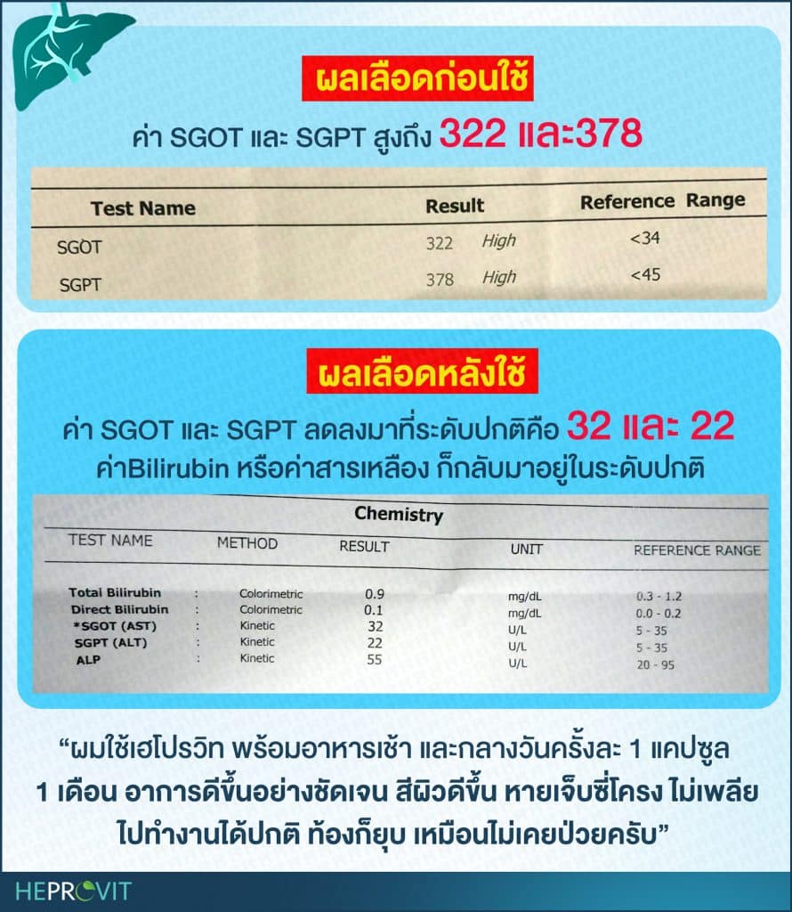 HEPROVIT เฮโปรวิท ฟื้นฟูตับ บำรุงตับ รักษาตับ ดีท็อกซ์ตับ ล้างสารพิษตับ ไขมันพอกตับ ตับอักเสบ ตับแข็ง ไวรัสตับอักเสบเอ ไวรัสตับอักเสบบี ไวรัสตับอักเสบซี มะเร็งตับ ตาเหลืองตัวเหลือง เจ็บชายโครงด้านขวา ง่วงกลางวัน ตื่นกลางคืน ดื่มแล้วเป็นผื่นแดง คันตามตัวไม่มีสาเหตุ มือเท้าบวม ท้องมาน ปวดตามข้อ ท้องอืด แน่น หายใจไม่สะดวก ดื่มเหล้า สุรา อ้วน ไขมัน