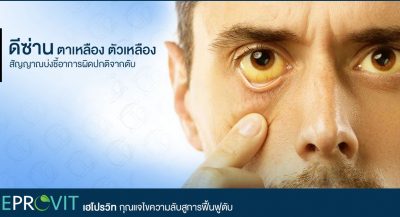 ดีซ่าน ตาเหลือง ตัวเหลือง ระวัง! สัญญาณบ่งชี้อาการผิดปกติจากตับ