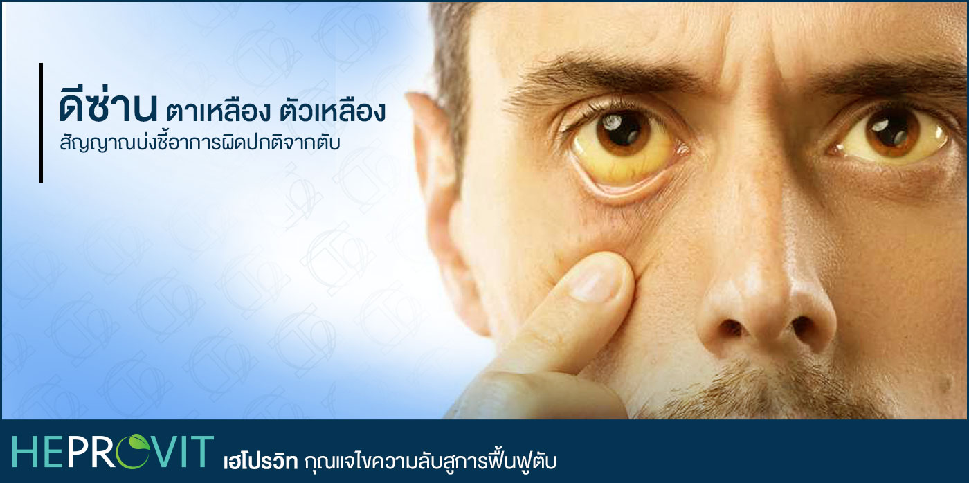 HEPROVIT เฮโปรวิท ฟื้นฟูตับ บำรุงตับ รักษาตับ ดีท็อกซ์ตับ ล้างสารพิษตับ ไขมันพอกตับ ตับอักเสบ ตับแข็ง ไวรัสตับอักเสบเอ ไวรัสตับอักเสบบี ไวรัสตับอักเสบซี มะเร็งตับ ตาเหลืองตัวเหลือง เจ็บชายโครงด้านขวา ง่วงกลางวัน ตื่นกลางคืน ดื่มแล้วเป็นผื่นแดง คันตามตัวไม่มีสาเหตุ มือเท้าบวม ท้องมาน ปวดตามข้อ ท้องอืด แน่น หายใจไม่สะดวก ดื่มเหล้า สุรา อ้วน ไขมัน